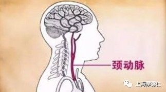 首先来说一下 【颈动脉】在哪儿——把手伸出来,摸一摸脖子两侧,有