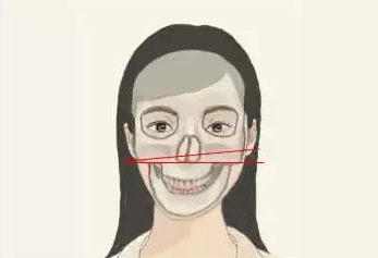 颅骨的塌陷和紊乱导致牙齿咬合平面的轴线与颅骨和脊柱的轴线不对齐.
