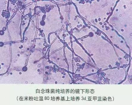 社会 正文  念珠菌龟头炎:主要是发生在龟头部位,病人多数是性活跃的