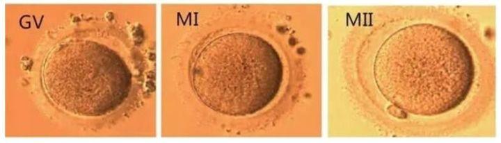 重新认识卵母细胞体外成熟(ivm)技术