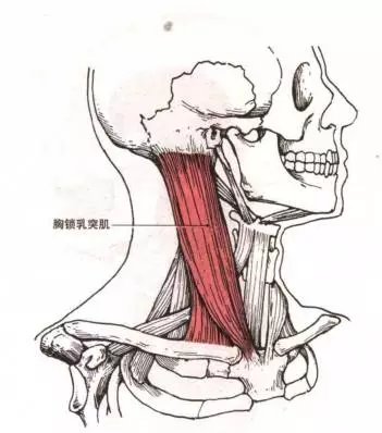 颈椎脖子痛!颈椎曲度变直?反弓?