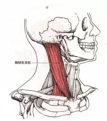 胸锁乳突肌位置示意图