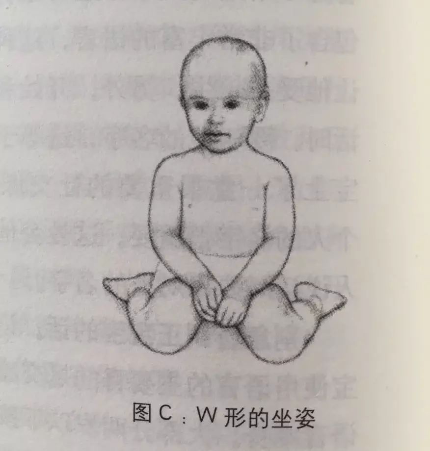 孩子w坐姿很可爱?赶紧改!小心影响腿发育!