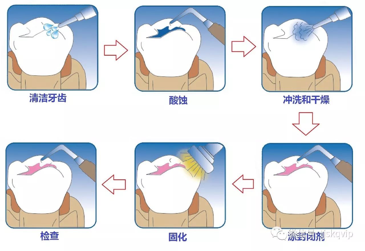 糖舌什么成语_成语故事图片(3)