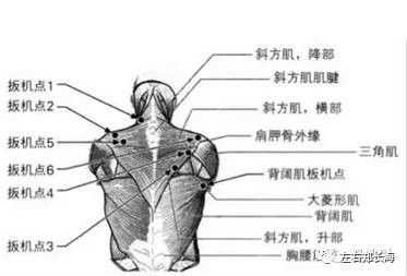 【禅舞·左右分享】找到扳机点,轻松解决疼痛问题