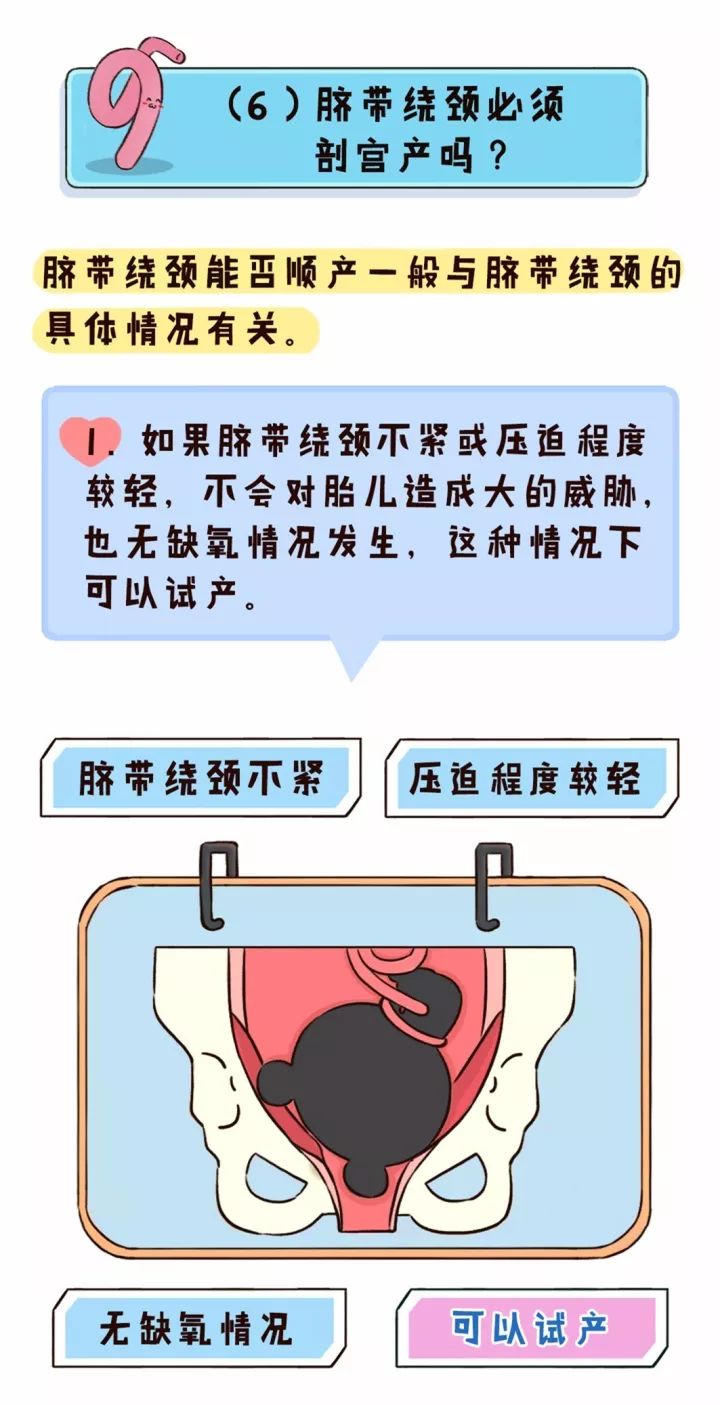 25周脐带绕颈一周怎么办