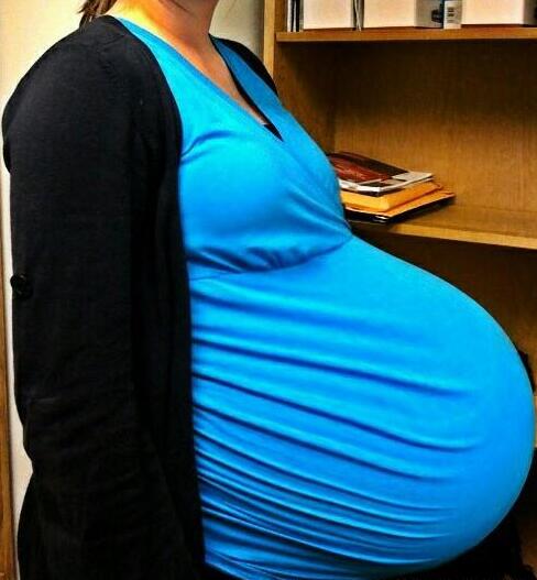 28岁孕妇顺产完双胞胎说肚子还在动医生检查后又取出一孩