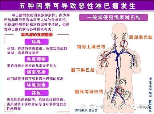 3,人的身体中有800多个淋巴结,人体上半身有400多个,光在颈部就有300