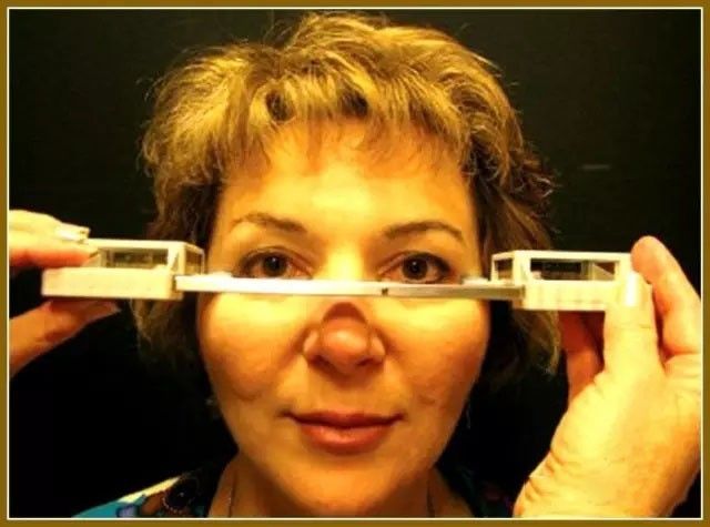 使用hertel 眼球突出计测量眼球突出程度,如大于18mm手术应谨慎