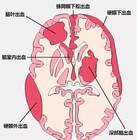 外周神经分布于全身,把脑和脊髓与全身其他器官联系起来,使中枢神经