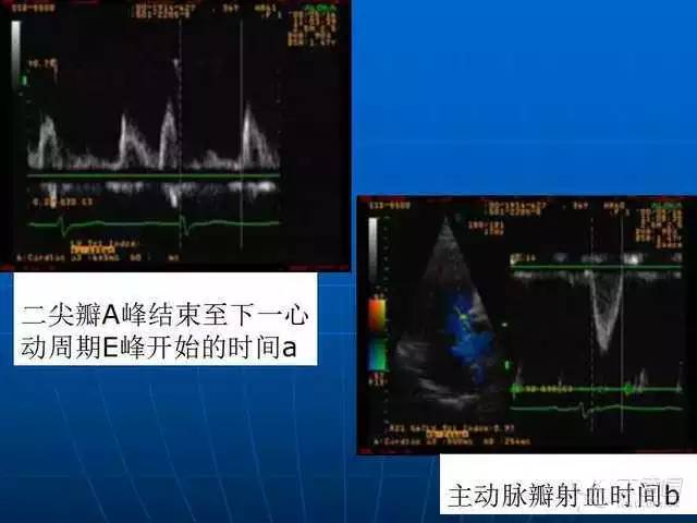 心内科基本功:超声心动图标准切面及正常值