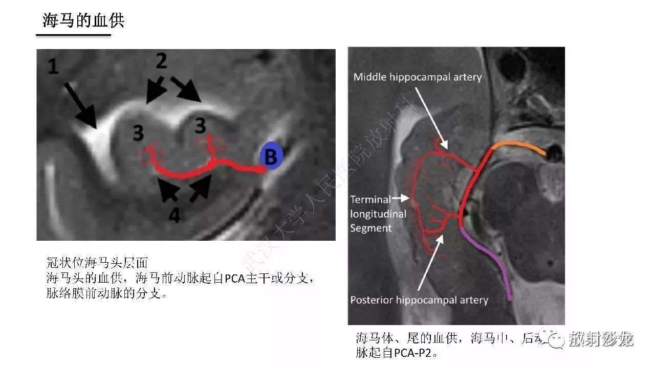 海马正常解剖与疾病影像诊断