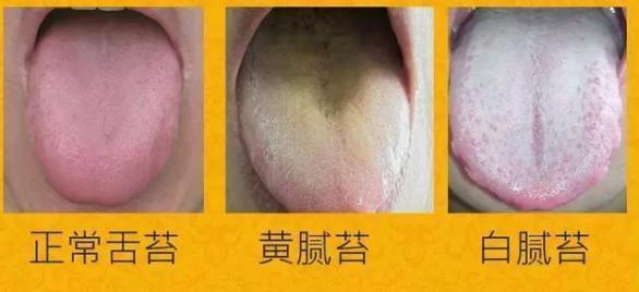 小儿推拿观舌辨病:如何从舌头看宝宝是否健康?