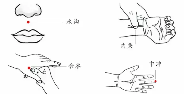 紧急情况下用拇指重力掐按水沟,合谷,内关穴,以病人出现疼痛反应并