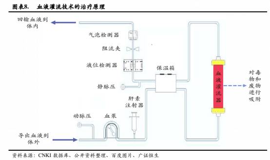 原理是将患者的血液从体内引流到体外,利用血液灌流器中的吸附剂对