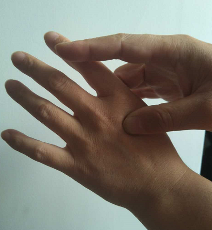 合谷穴位置在一手的拇指第一个关节横纹正对另一手的虎口边,拇指屈曲