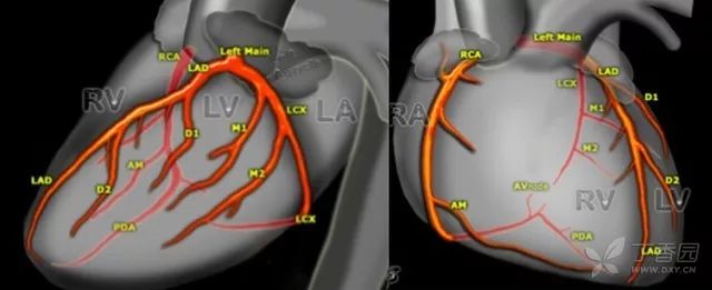 侧位和正位示意图,可见重要三支血管 lad,lc,rca