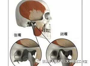 自我康复习惯与颞下颌关节紊乱病