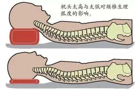 5,保持良好的睡眠体位,选择合适的枕头,"高枕"并非"无忧".