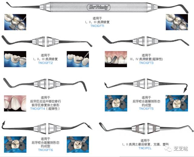 豪孚迪树脂充填器使用方法:美学树脂修复病例视频操作