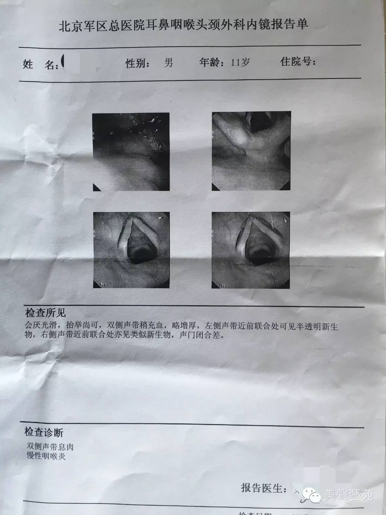 艺术嗓音专题咽音练声修复青少年声带息肉治愈嗓音病变