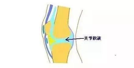 膝关节疼痛,坐立难安,可以通过佩戴护膝来给膝关节加温,促进疼痛因子