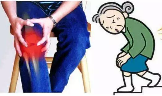 「膝盖疼痛」很可能与这些疾病有关!