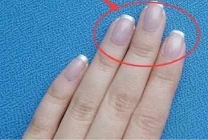 指甲发紫中医认为指甲质地坚硬是肝血充足的体现.