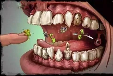 食物塞进牙缝里的瞬间,如果你感觉到疼,那就是已经对牙龈造成了机械