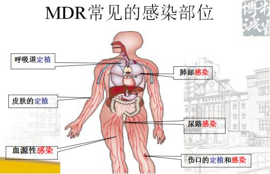 疾病人口迁移_人口迁移思维导图(3)