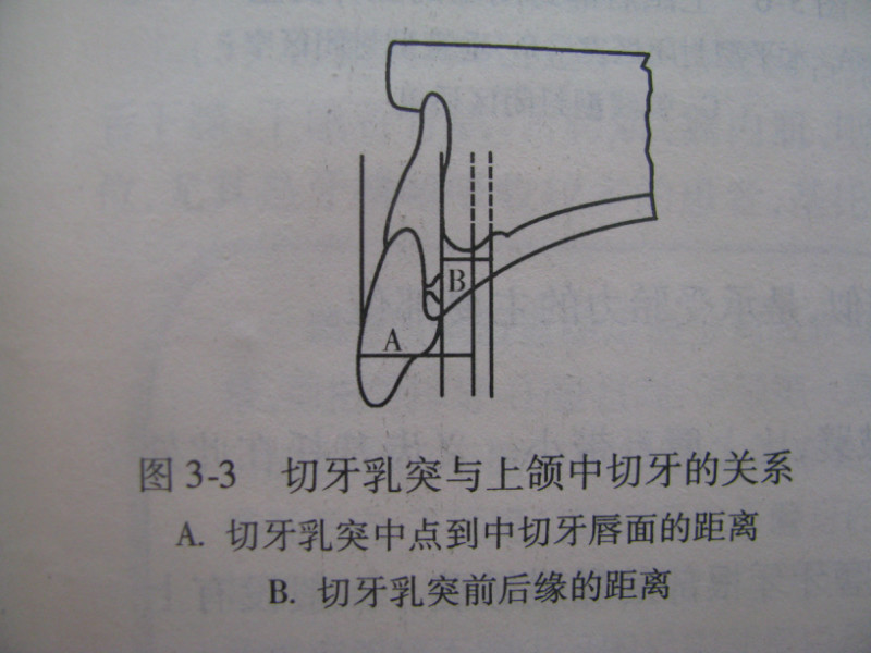 切牙乳突1切牙乳突 2 唇系带 3颊系带