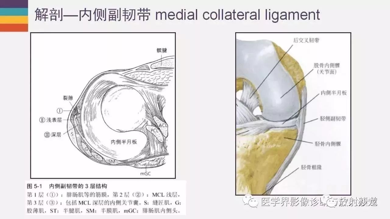 膝关节内侧副韧带受伤?mr来确诊!