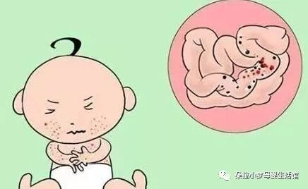 【育儿小知识】宝宝腹泻,怎么判断是牛奶蛋白过敏,还是乳糖不耐受症
