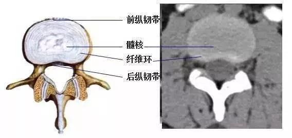 脊椎前,后纵韧带,椎间盘髓核,纤维环73 2,髓核髓核呈胶状物,由类