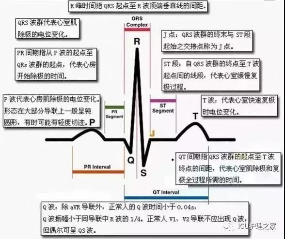 干货|心电图快速记忆