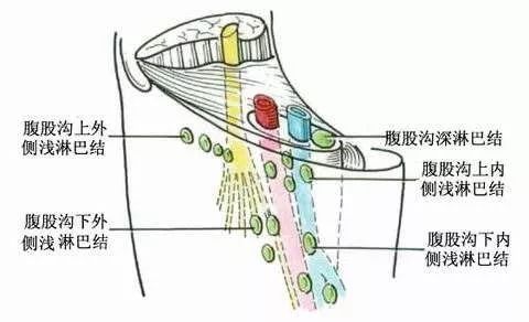 腹股沟淋巴