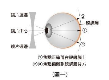 塑形镜的原理_△角膜塑形镜视力矫正原理