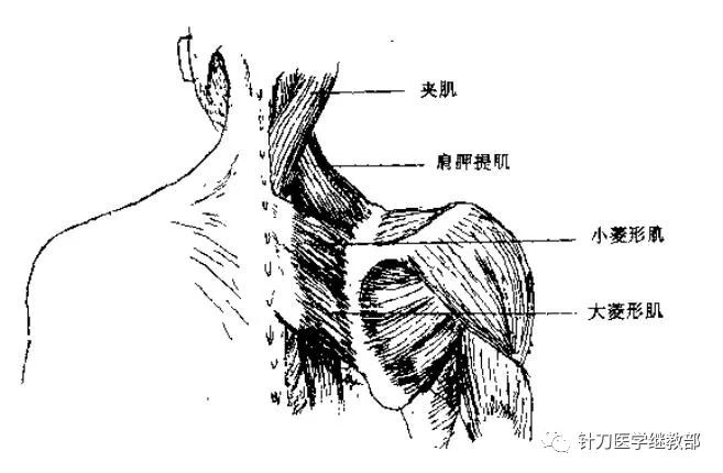 骨并使肩胛骨转向内上方(见图三十七和三十八)局部解剖肩胛提肌的损伤