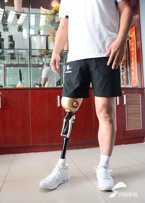 "我的腿长出来了!" 济南一残疾人帮助残疾儿童重获新生