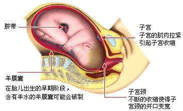 第一产程 (宫颈扩张期):指宫缩30秒左右,间歇5～6分钟开始,到子宫颈口