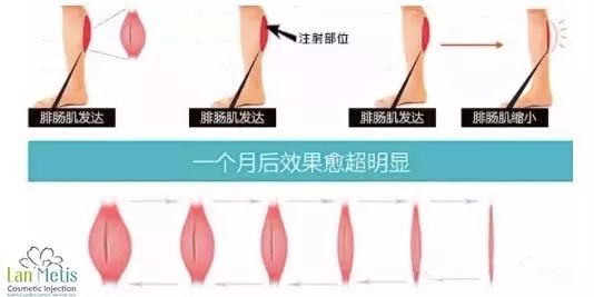 针久的原理_103电针灸治疗仪原理图(3)