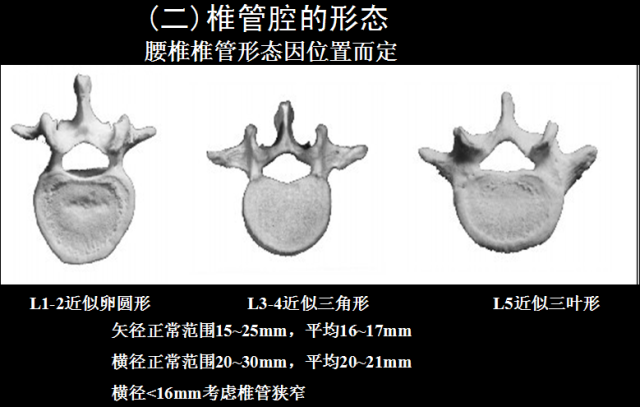 史上最详细的椎管结构影像图,果断收藏!