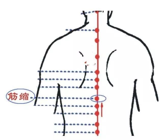 肝主筋,地筋隐于足,揉地筋必有神奇功效