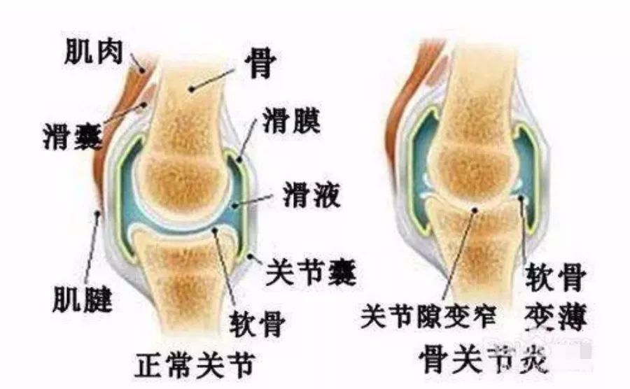 龚志贤副教授介绍:中医黄帝内经有云:"膝者,筋之府也;腰者,肾之府也