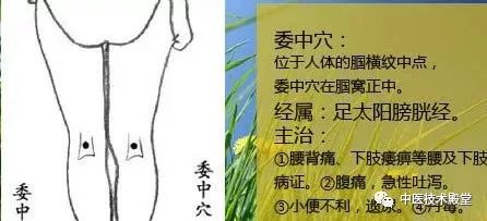 1委中穴在腿弯正中(腘窝横纹的中点处),古云"腰背委中求".