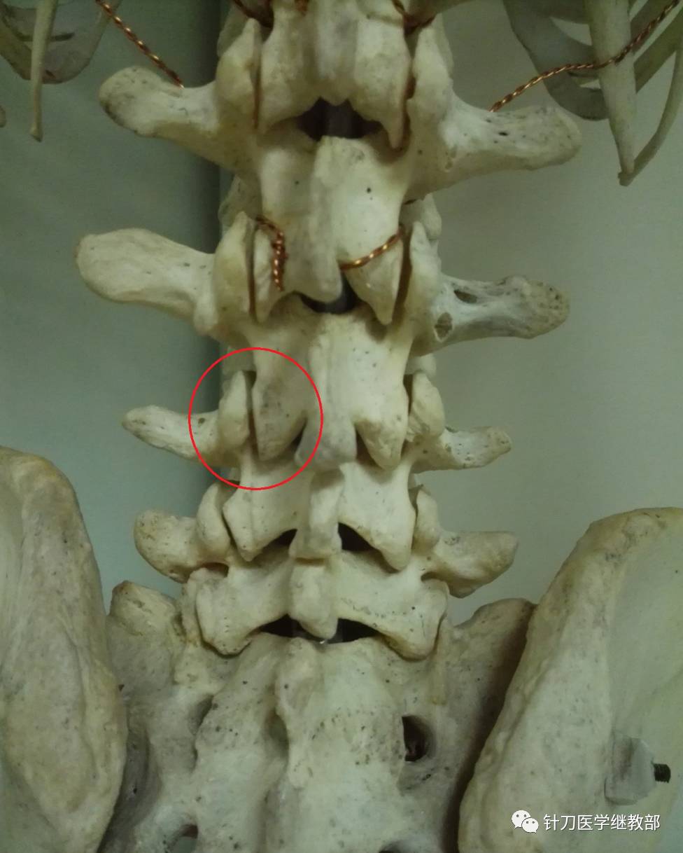 容易被忽视的腰痛原因——腰椎关节突源性腰痛