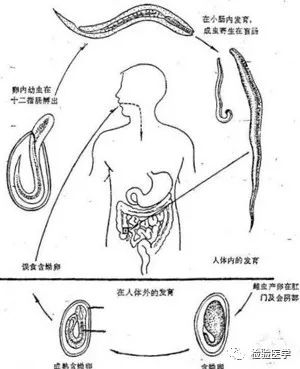 "神龙"见首不见尾!又见蛲虫一例