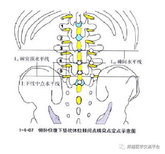 针刀篇腰骶部针刀治疗