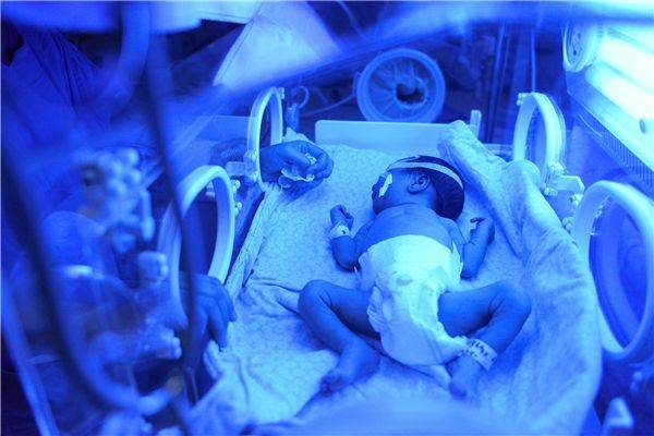 早于48小时,或者是黄疸值到达临界点(20),医生可能会建议宝宝照蓝光