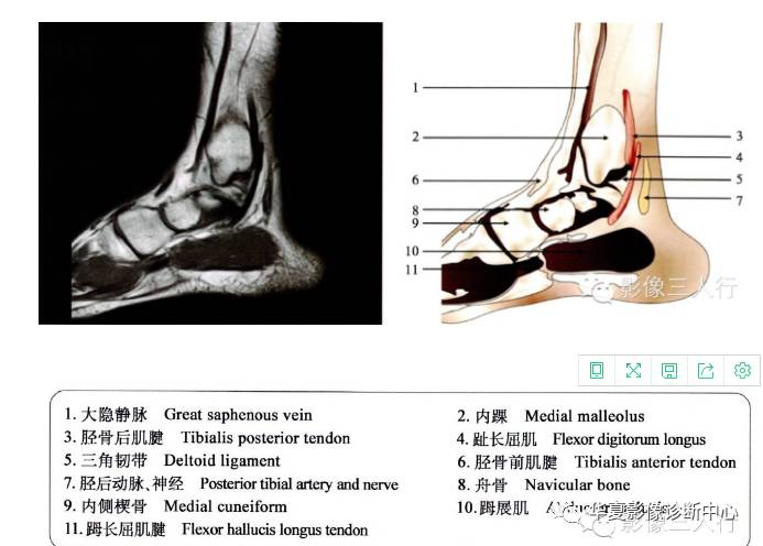 精美图片:"踝和足"的断层解剖图谱
